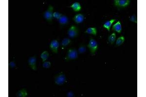 Immunofluorescence staining of A549 cells with ABIN7164015 at 1:50, counter-stained with DAPI.