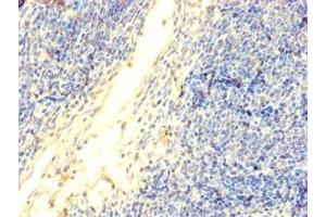 Immunohistochemistry of paraffin-embedded human thymus tissue using ABIN7150213 at dilution of 1:100 (TdT Antikörper  (AA 1-509))