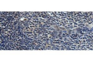 Immunohistochemistry of paraffin-embedded Human tonsil tissue using HAUS6 Polyclonal Antibody at dilution of 1:45(x200) (FAM29A Antikörper)