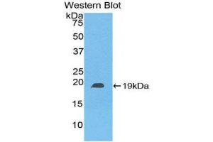 Western Blotting (WB) image for anti-Heat Shock Protein, alpha-Crystallin-Related, B6 (HSPB6) (AA 1-162) antibody (ABIN5661998)