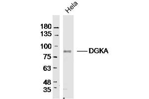 Hela lysates probed with DGKA Polyclonal Antibody, Unconjugated  at 1:300 dilution and 4˚C overnight incubation. (DGKA Antikörper  (AA 201-300))