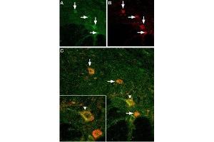 Expression of TRPV3 in mouse spinal cord - Immunohistochemical staining of mouse spinal cord using Anti-TRPV3 (extracellular) Antibody (ABIN7043847, ABIN7043992 and ABIN7043993).