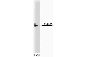 Western blot analysis of PKA [RIalpha] on a rat cerebrum lysate. (PKA R1 alpha (PKR1) (AA 1-381) Antikörper)