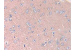 Detection of JAK2 in Rat Cerebrum Tissue using Polyclonal Antibody to Janus Kinase 2 (JAK2)