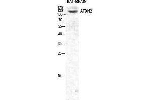 Western Blot (WB) analysis of specific cells using Ataxin-2 Polyclonal Antibody. (Ataxin 2 Antikörper  (Internal Region))