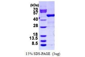 ARHGDIB Protein (GST tag)