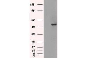 Image no. 1 for anti-Solute Carrier Family 2 (Facilitated Glucose/fructose Transporter), Member 5 (SLC2A5) antibody (ABIN1498473) (SLC2A5 Antikörper)