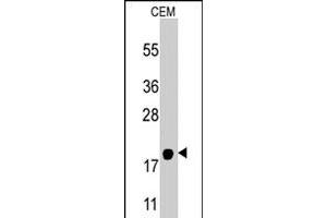 Western blot analysis of PPBP polyclonal antibody  in CEM cell line lysates (35 ug/lane). (CXCL7 Antikörper  (AA 99-128))