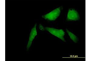 Immunofluorescence of purified MaxPab antibody to SSX2IP on HeLa cell. (SSX2IP Antikörper  (AA 1-614))