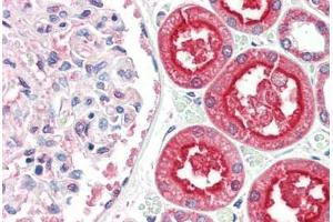 Human Kidney (formalin-fixed, paraffin-embedded) stained with ACE2 antibody ABIN461888 at 2. (ACE2 Antikörper  (Internal Region))