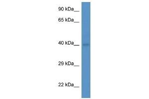 Western Blot showing Abo antibody used at a concentration of 1.