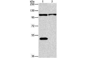 Western Blotting (WB) image for anti-NLR Family, Pyrin Domain Containing 3 (NLRP3) antibody (ABIN2427660) (NLRP3 Antikörper)