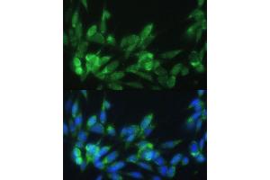 Immunofluorescence analysis of NIH-3T3 cells using LRP Polyclonal Antibody (ABIN3017160, ABIN3017161, ABIN1680715 and ABIN6219979) at dilution of 1:100 (40x lens). (LRPAP1 Antikörper)