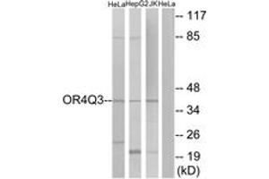 Western blot analysis of extracts from HeLa/Jurkat/HepG2 cells, using OR4Q3 Antibody. (OR4Q3 Antikörper  (AA 264-313))