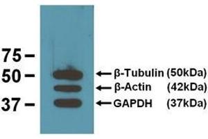 EBI’s three loading control mAbs reacting against 10μg/lane of mouse brain tissue lysates. (TUBB Antikörper)
