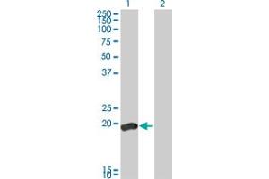 Dual Specificity Phosphatase 3 (DUSP3) (AA 1-185) Antikörper