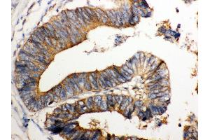 IHC(P): Human Intestinal Tissue (NMI Antikörper  (AA 2-307))