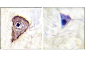 Immunohistochemistry analysis of paraffin-embedded human brain, using VEGFR1 (Phospho-Tyr1333) Antibody.