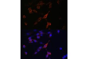 Immunofluorescence (IF) image for anti-RAB21, Member RAS Oncogene Family (RAB21) (AA 1-225) antibody (ABIN6146556)