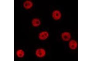 ABIN6278379 staining 293T by IF/ICC. (SSB Antikörper  (Internal Region))