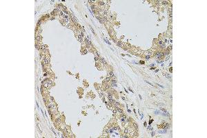 Immunohistochemistry of paraffin-embedded human prostate using KCNJ3 antibody (ABIN6003556) at dilution of 1/100 (40x lens). (KCNJ3 Antikörper)