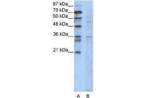 WB Suggested Anti-CCNB3 Antibody Titration:  2. (Cyclin B3 Antikörper  (N-Term))