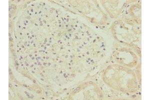Immunohistochemistry of paraffin-embedded human kidney tissue using ABIN7174751 at dilution of 1:100 (C17ORF47 Antikörper  (AA 1-300))