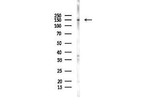 Western blot analysis of lysates from F10-LUC cells(heat-shock 45 min treatment), using GPR116 Antibody at 1/1000 dilution.