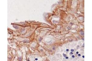 Image no. 1 for anti-Desmoglein 3 (DSG3) antibody (ABIN1721896) (Desmoglein 3 Antikörper)