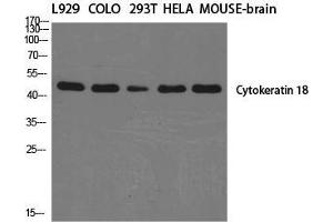Western Blot (WB) analysis of specific cells using Cytokeratin 18 Polyclonal Antibody. (Cytokeratin 18 Antikörper  (C-Term))
