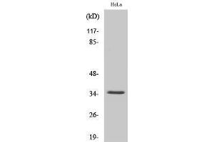 Western Blotting (WB) image for anti-Solute Carrier Family 25 (Mitochondrial Carrier, Adenine Nucleotide Translocator), Member 31 (SLC25A31) (Internal Region) antibody (ABIN3179873) (SLC25A31 Antikörper  (Internal Region))