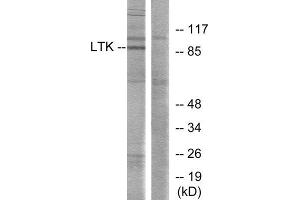 Western Blotting (WB) image for anti-Leukocyte Receptor tyrosine Kinase (LTK) (Internal Region) antibody (ABIN1849300)