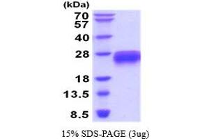 SDS-PAGE (SDS) image for TNF Receptor Superfamily, Member 6 (FAS) (AA 26-173) (Active) protein (His tag) (ABIN7540045)