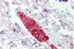 ABIN185737 (5µg/ml) staining of paraffin embedded Human Colon. (FEZ1 Antikörper  (Internal Region))