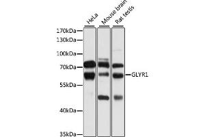Western blot analysis of extracts of various cell lines, using GLYR1 antibody (ABIN6133101, ABIN6141170, ABIN6141171 and ABIN6224873) at 1:1000 dilution. (GLYR1 Antikörper  (AA 70-270))