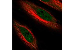 Immunofluorescent staining of human cell line HeLa with CDKN1C polyclonal antibody  at 1-4 ug/mL concentration shows positivity in nucleus but excluded from the nucleoli. (CDKN1C Antikörper)