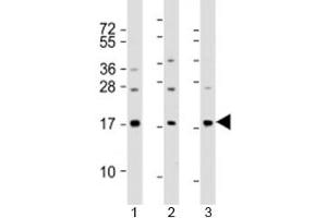 Western blot testing of human 1) A549, 2) HeLa and 3) spleen lysate with PLA2 antibody at 1:2000. (PLA2G1B Antikörper  (AA 106-135))