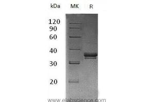 Western Blotting (WB) image for Exostoses (Multiple)-Like 2 (EXTL2) protein (His tag) (ABIN7320520)