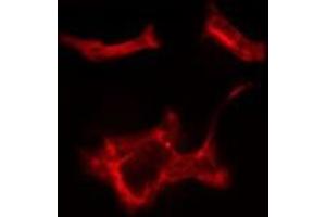 ABIN6279729 staining HeLa cells by IF/ICC. (RAB1B Antikörper  (Internal Region))