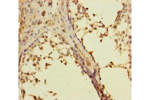 Immunohistochemistry of paraffin-embedded human testis tissue using ABIN7167274 at dilution of 1:100 (RAB27B Antikörper  (AA 1-218))