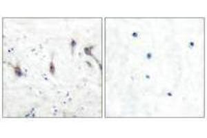 Immunohistochemical analysis of paraffin-embedded human brain tissue using ARC antibody. (ARC Antikörper)