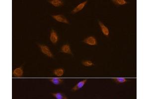 Immunofluorescence analysis of L929 cells using TSG101 Polyclonal Antibody at dilution of 1:100. (TSG101 Antikörper)