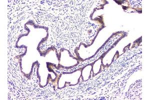 IHC analysis of RAB11B using anti-RAB11B antibody (ABIN6719364). (RAB11B Antikörper)