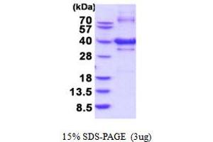 SDS-PAGE (SDS) image for Nucleotide Binding Protein 1 (NUBP1) (AA 1-320) protein (His tag) (ABIN5854180) (NUBP1 Protein (AA 1-320) (His tag))