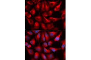 Immunofluorescence (IF) image for anti-DEAD (Asp-Glu-Ala-Asp) Box Polypeptide 3, X-Linked (DDX3X) antibody (ABIN1876838) (DDX3X Antikörper)