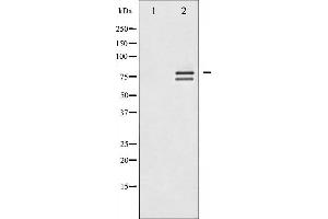 Western blot analysis of Lamin A/C expression in HeLa whole cell lysates,The lane on the left is treated with the antigen-specific peptide. (Lamin A/C Antikörper  (Internal Region))
