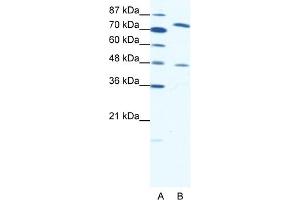 WB Suggested Anti-ZNF225 Antibody Titration:  0. (ZNF225 Antikörper  (N-Term))