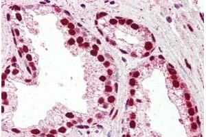Human Prostate (formalin-fixed, paraffin-embedded) stained with IRF6 antibody ABIN461925 at 2. (IRF6 Antikörper  (AA 455-467))