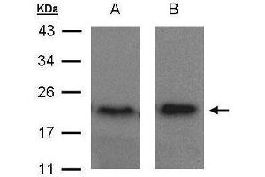 WB Image Sample(30 μg of whole cell lysate) A:MOLT4, B:Raji, 15% SDS PAGE antibody diluted at 1:1500 (ARF5 Antikörper)