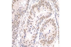 Immunohistochemistry (IHC) image for anti-Paf1, RNA Polymerase II Associated Factor, Homolog (PAF1) (AA 475-525) antibody (ABIN7448713)